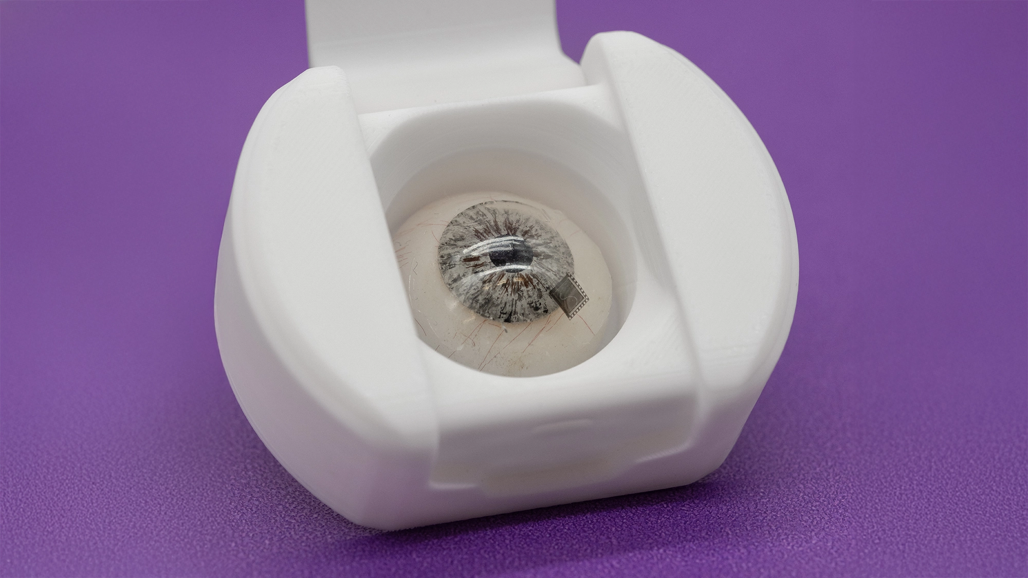 Lente de contacto inteligente diseñada para la monitorización y gestión del glaucoma mediante tecnología integrada.